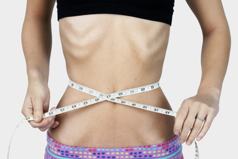 ANOREXIA