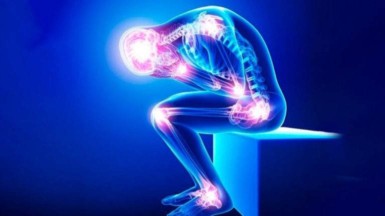 Fibromialgia
