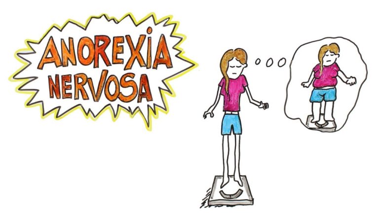 ANOREXIA NERVOSA
