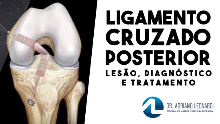 Lesão dos Ligamentos Cruzados