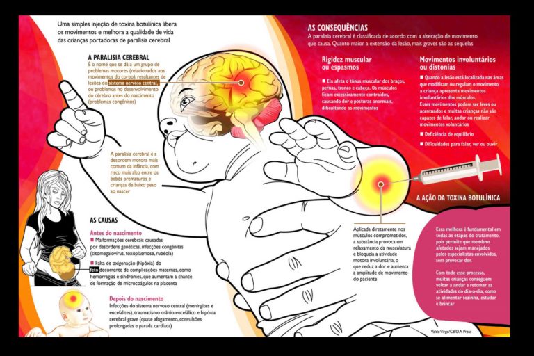 O que é a Paralisia Cerebral?