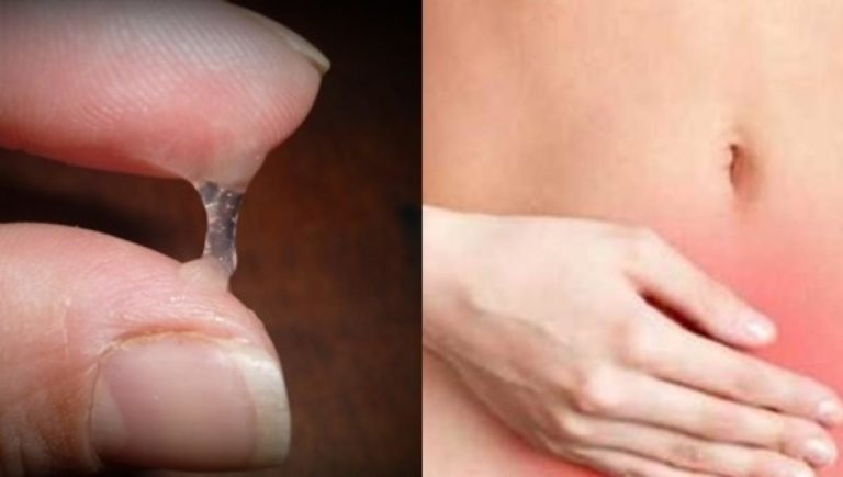 CORRIMENTO VAGINAL