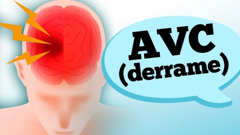DERRAME – ACIDENTE VASCULAR CEREBRAL