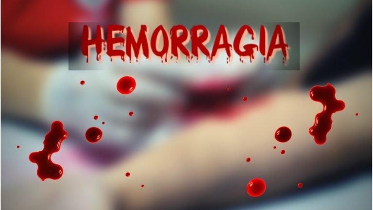 HEMORRAGIA UTERINA DISFUNCIONAL