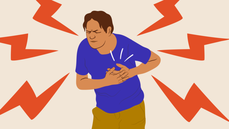 INFARTO