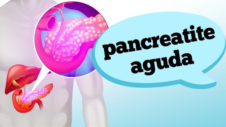 PANCREATITE AGUDA