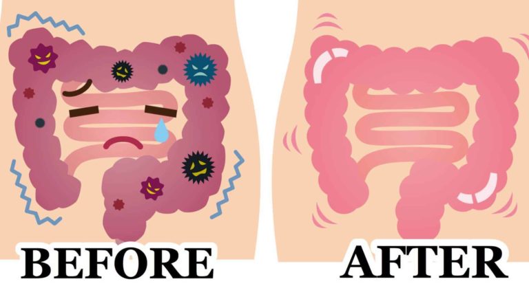 Colon Therapy and Food Digestion