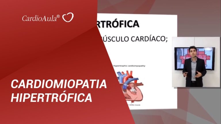 CARDIOMIOPATIA HIPERTRÓFICA