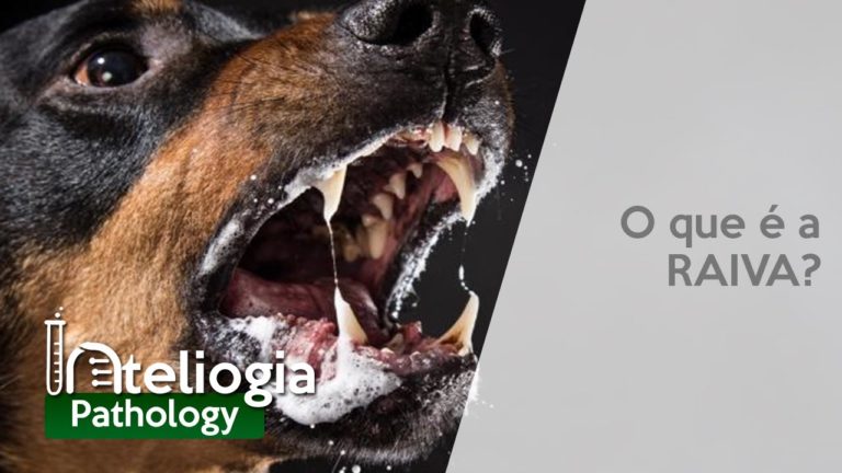 RAIVA OU HIDROFOBIA