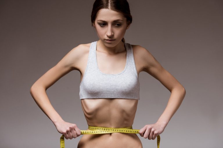 ANOREXIA