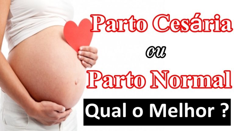 CESARIANA X PARTO NORMAL 1/2