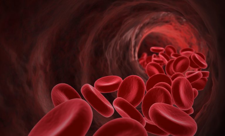 TROMBOSE VENOSA PROFUNDA E TROMBOEMBOLISMO PULMONAR