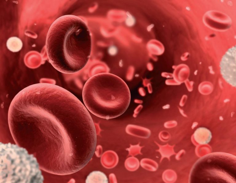 ANEMIA PERNICIOSA