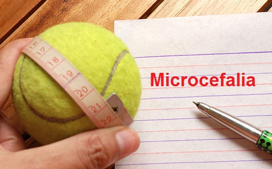 MICROCEFALIA
