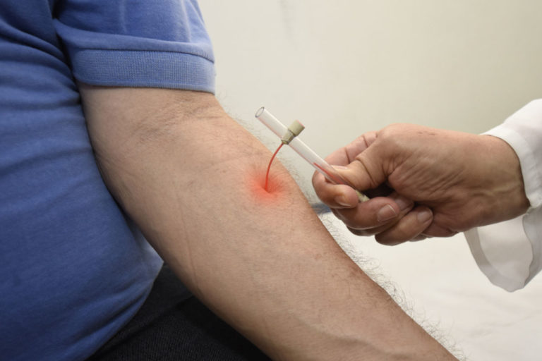 Assistência de Enfermagem a pacientes portadores de Hanseníase