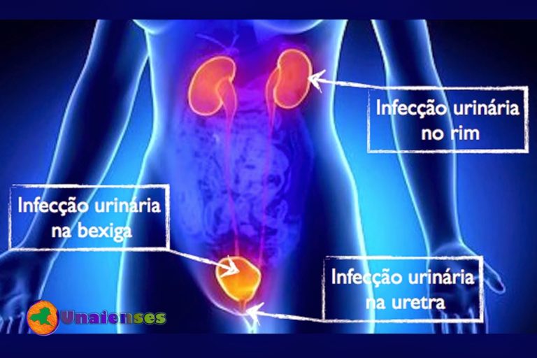 A Importância da Enfermagem Junto ao Portador de Bexiga Neurogênica