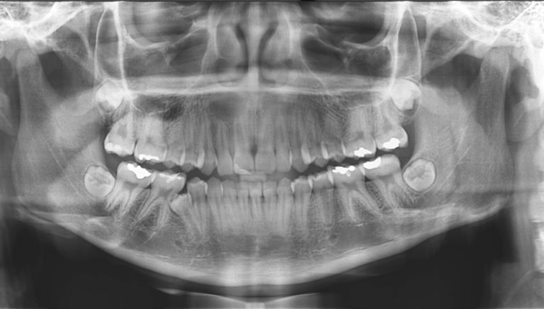 Radiografia Panorâmica