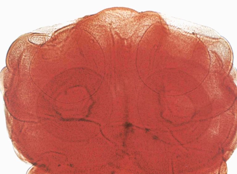 Taenia Solium